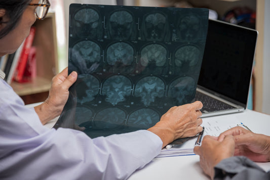 Doctor checking brain x-rays with patient to understand Alzheimer's